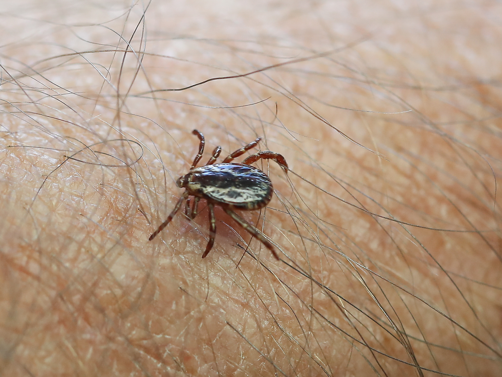 Photo of a blacklegged tick on a person's arm