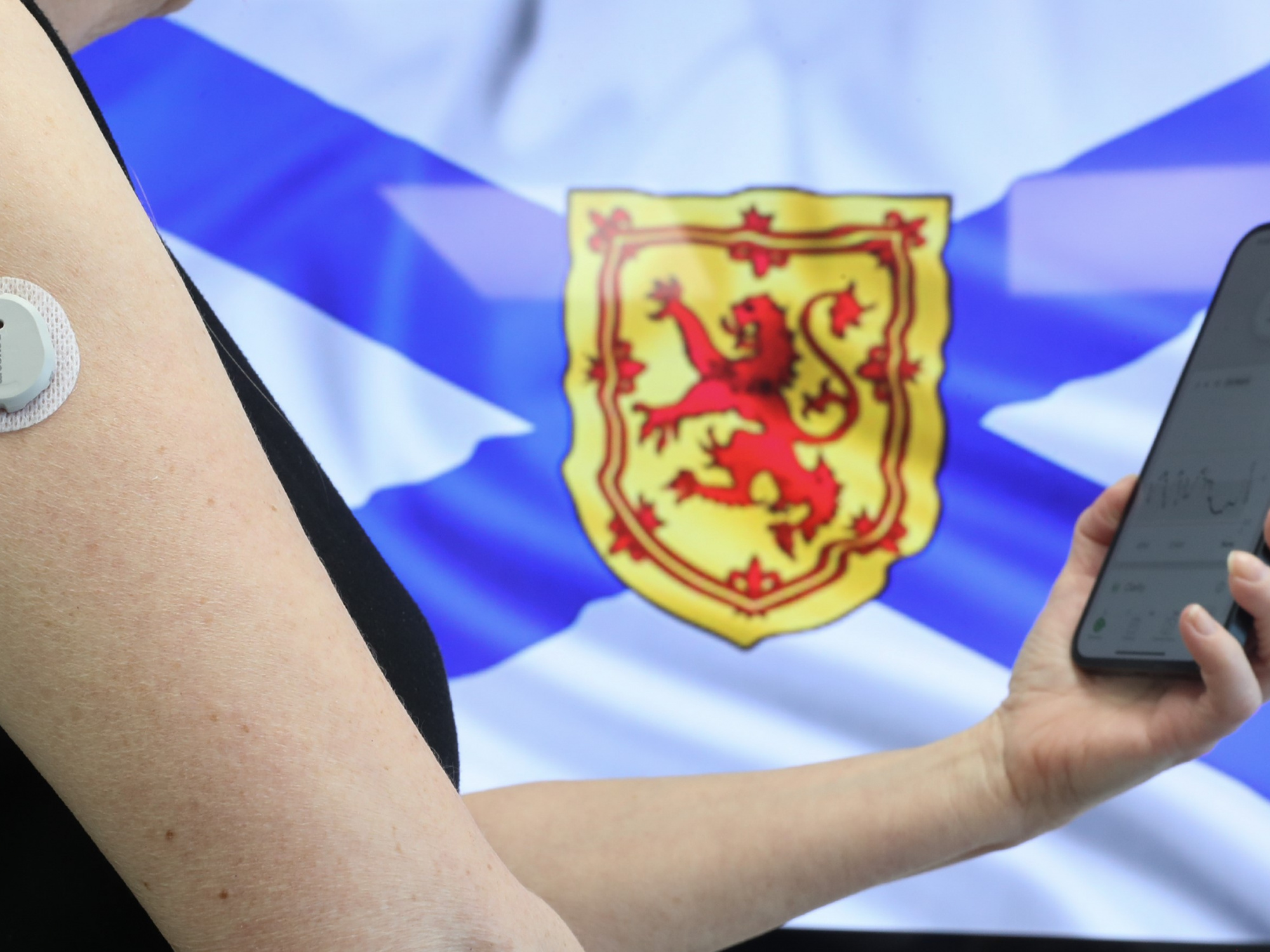 Photo of glucose monitor on a person's arm and the person holding a cellphone